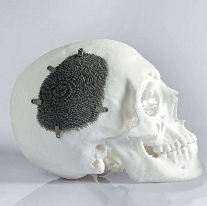 顱骨模型3D打印